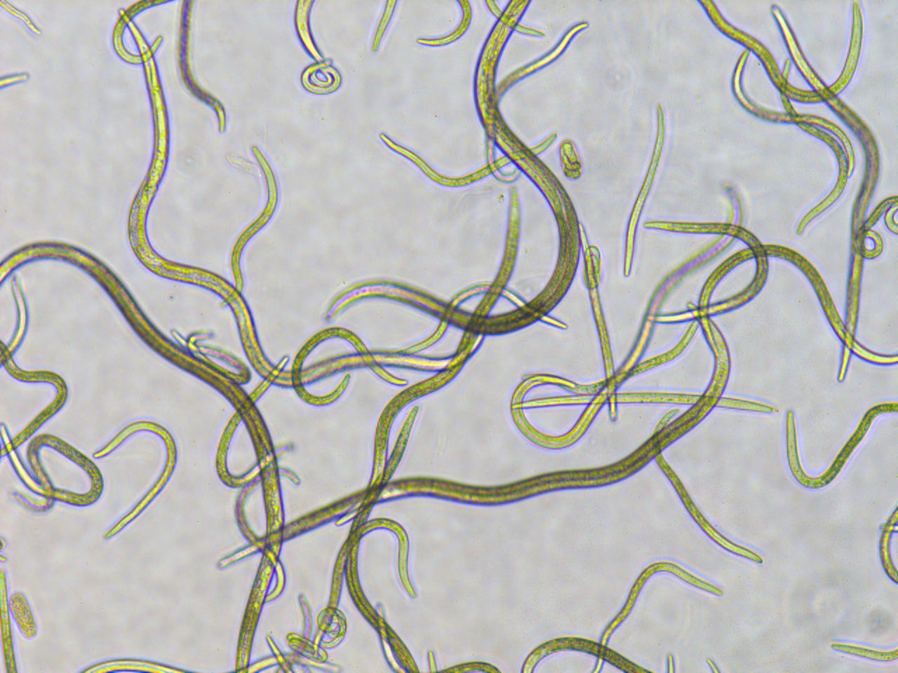 소나무 재선충 현미경사진